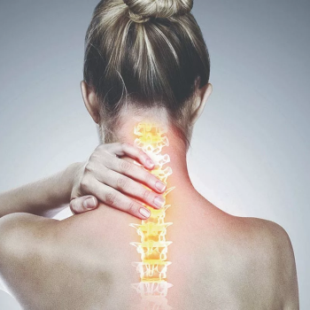 Spondiloza cervicală: cauze, simptome, tratament