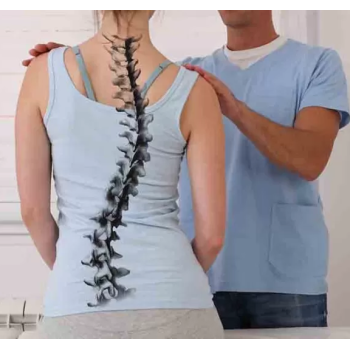 Ce este scolioza lombară și cum o puteți preveni